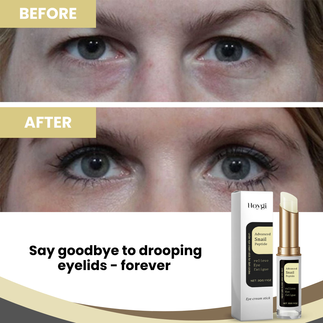 š„BUY 2 GET 1 FREEš„ Eye Balm Stick | Achieve 87% Firmer, Lifted Eyelids in Just 2 Hours