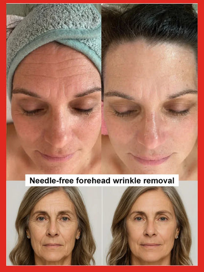 🔥BUY 2 GET 1 FREE🔥 Salmon Water Light Anti-Wrinkle Essence  (🎁Flash Sale - Don’t Miss Out)