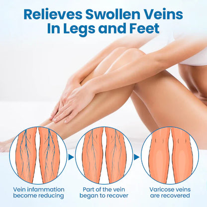 Timilk® VeinGuard Herbal Spray-✅ Clinically proven to eliminate varicose veins in just 7 days!