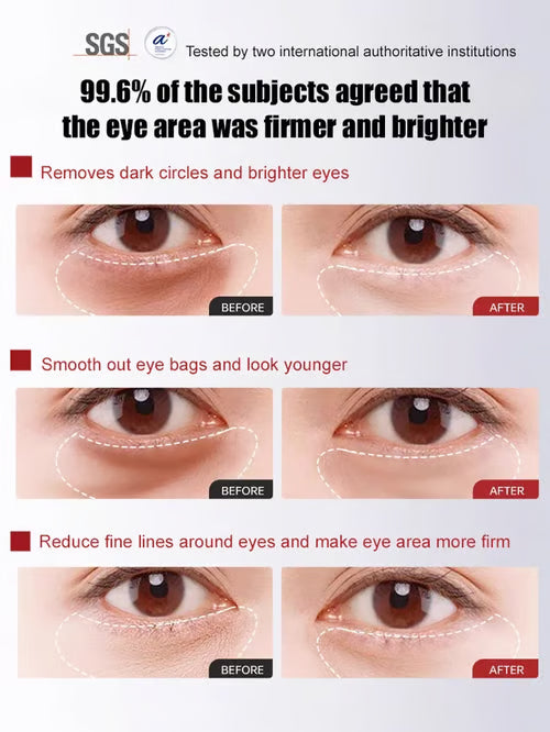 🔥BUY 2 GET 1 FREE🔥 Herbal Anti-Wrinkle Firming Eye Cream  (🎁Flash Sale - Don’t Miss Out)