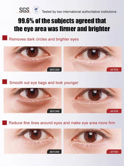 🔥BUY 2 GET 1 FREE🔥 Herbal Anti-Wrinkle Firming Eye Cream  (🎁Flash Sale - Don’t Miss Out)